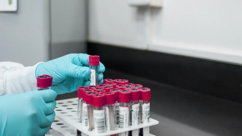 Badania hormonalne UK: Kluczowe informacje dla kobiet
