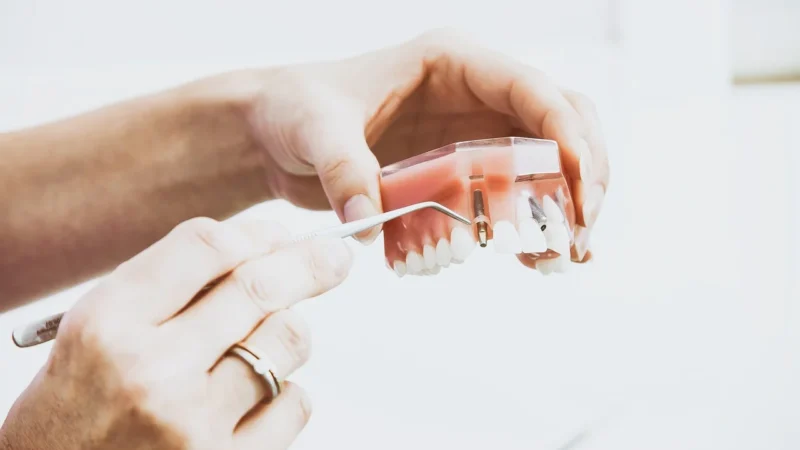 Dentysta w święta – czy możemy liczyć na pomoc w trakcie świąt?
