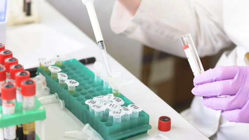 Felixstowe Lekarz: Nowe Możliwości Laboratoriów Medycznych w Londynie