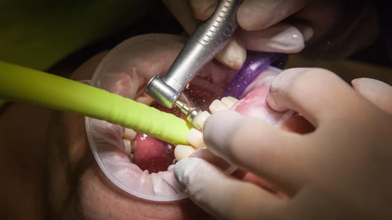 Implanty dentystyczne w Polskiej Klinice Stomatologicznej w Wielkiej Brytanii: Co Musisz Wiedzieć