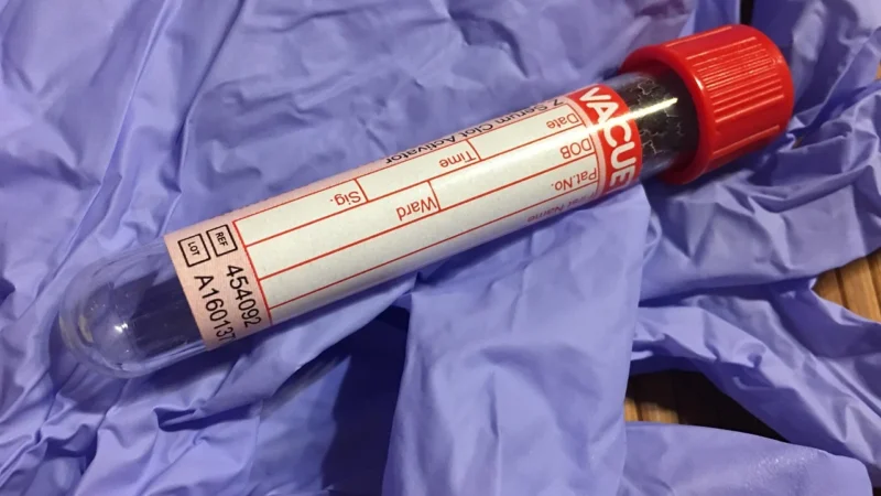 Lipidogram: Co to jest i jakie są jego ceny?
