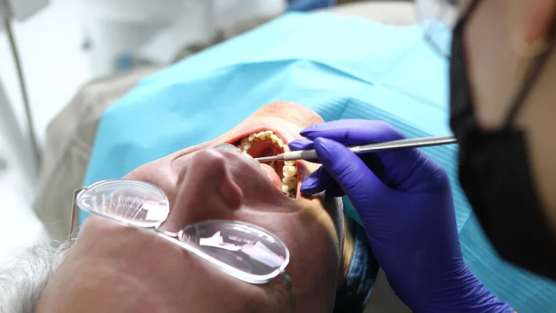 Sablare dentară: W jaki sposób może to pomóc Twoim zębom?