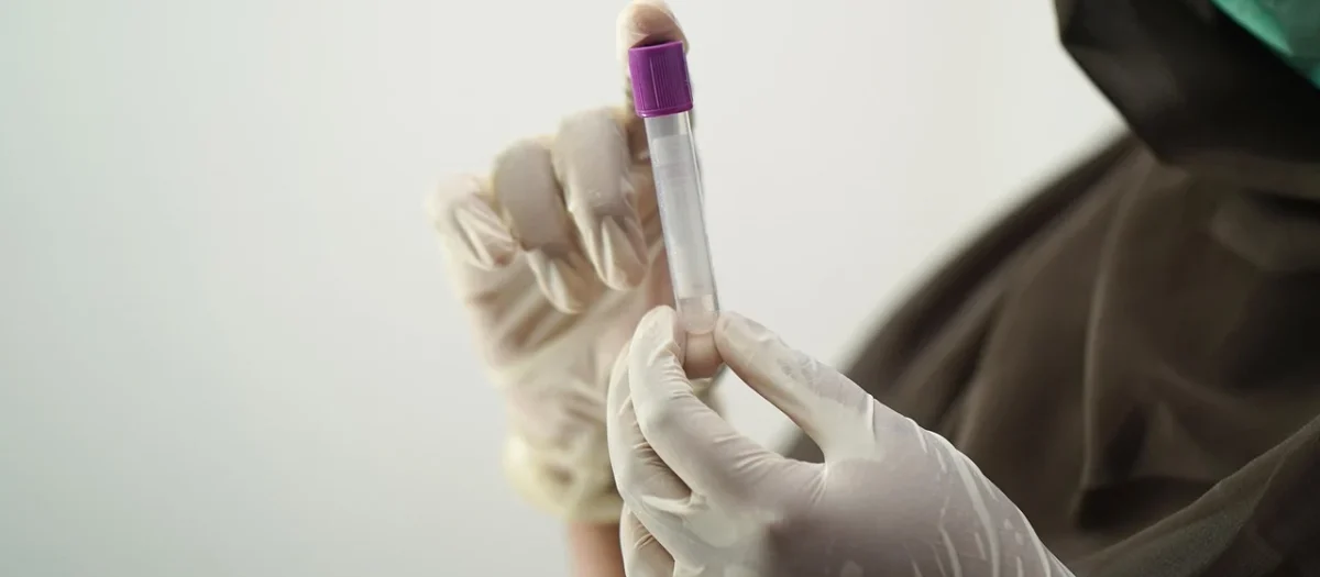 Zaawansowane badania laboratoryjne w Londynie: Jak znaleźć najlepsze laboratorium analiz medycznych