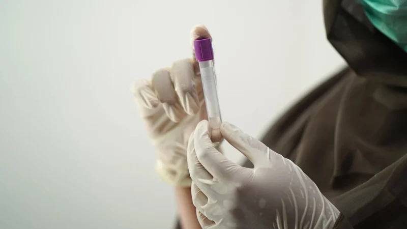 Zaawansowane badania laboratoryjne w Londynie: Jak znaleźć najlepsze laboratorium analiz medycznych