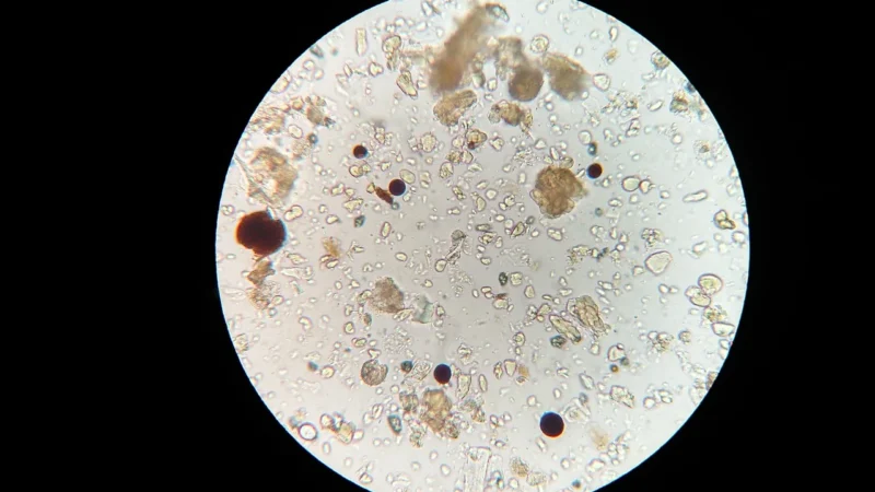 Znaczenie badania mikologicznego w diagnostyce grzybic